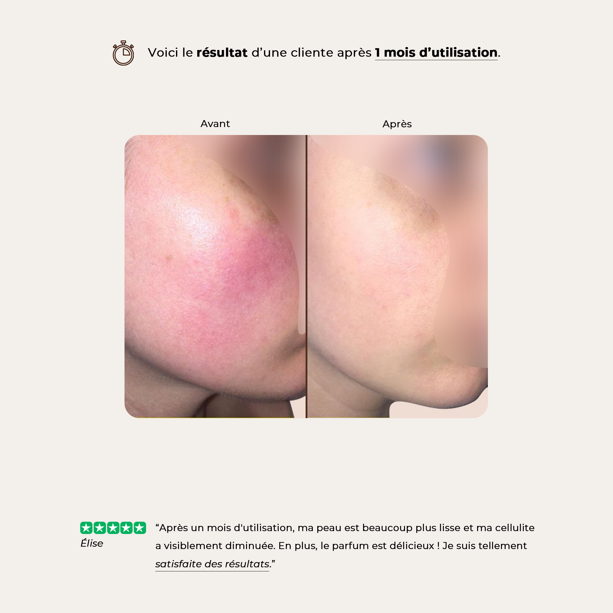 Crème hydratante Anti-cellulite