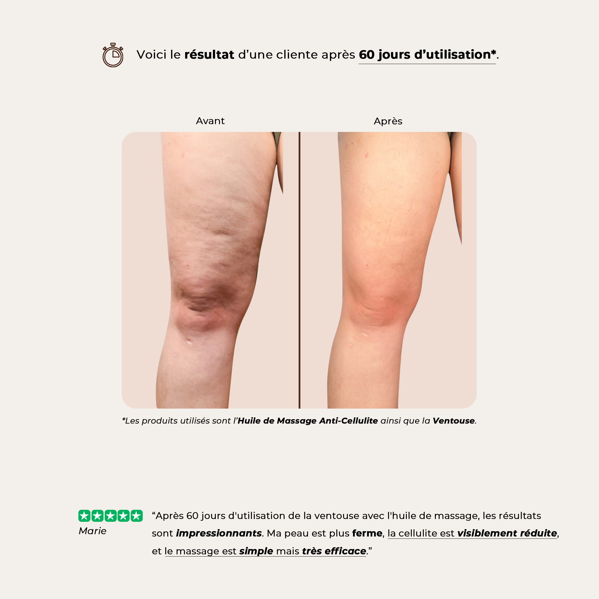 Ventouse Anti-Cellulite